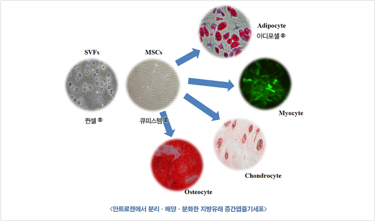 지방유래 중간엽줄기세포 설명 이미지